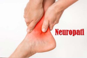 Gejala neuropati